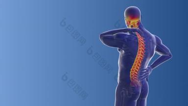 颈背痛的医学概念